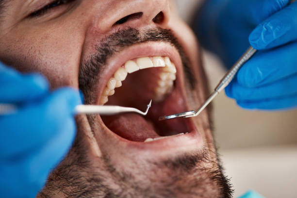 Best Emergency Root Canal Treatment in Madison, FL